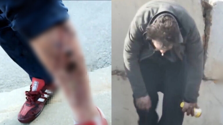 Penyalahgunaan ubat penenang haiwan menyebabkan manusia menjadi ‘zombie’