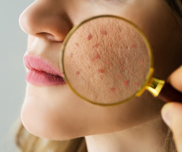 Pantang makanan ini jika mahu berseri di hari raya